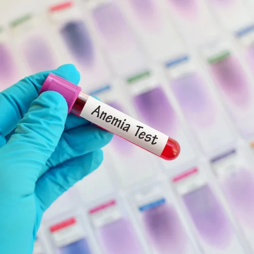 Anemia 1