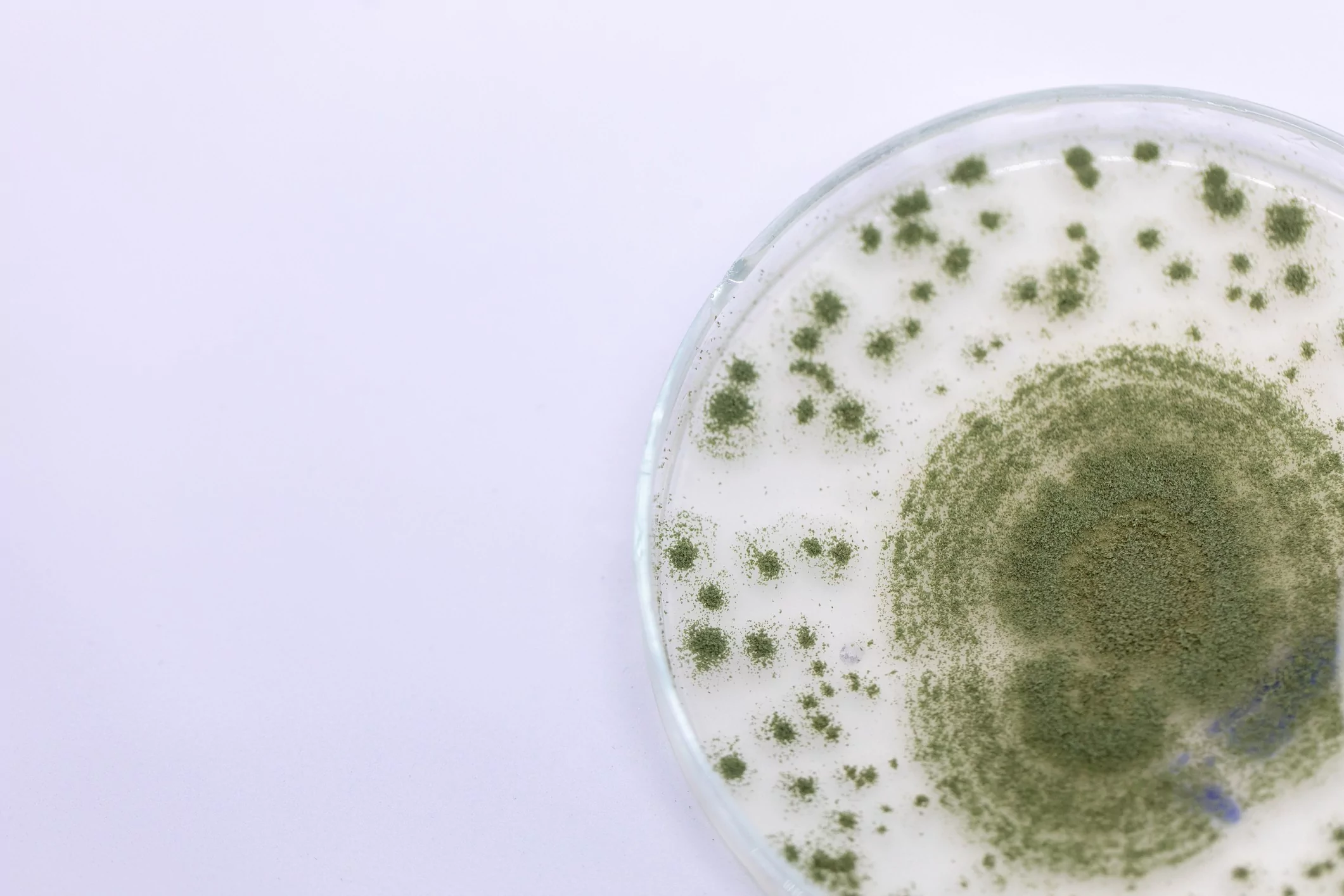 Aspergilose - Imunologia