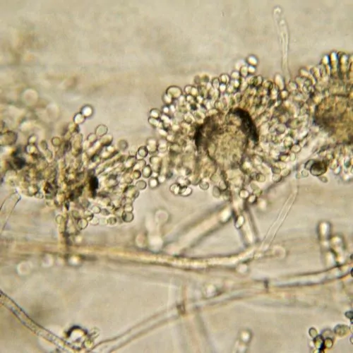 Micrografia de molde de pão Aspergillus