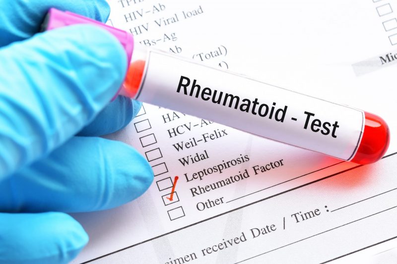 Amostra de sangue para teste de fator reumatóide (RF)