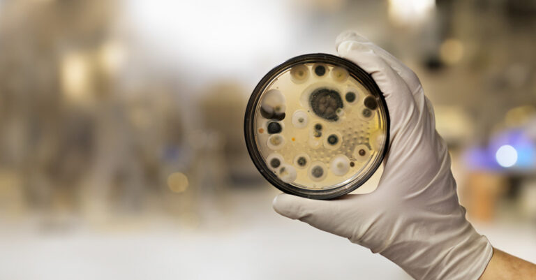 Diagnóstico laboratorial das micoses: raciocínio clínico-laboratorial na rotina diagnóstica