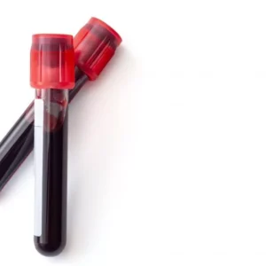 Imunohematologia Automacao e1611930625746
