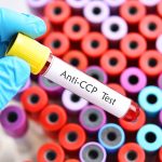 Tubo de amostra de sangue para teste anti-CCP