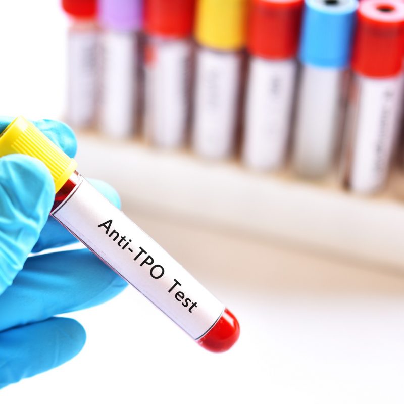 Tubo de amostra de sangue para teste anti-TPO