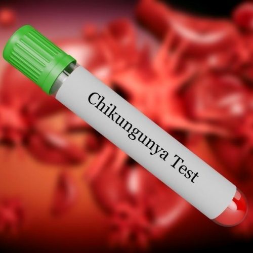 Imunologia Chikungunya