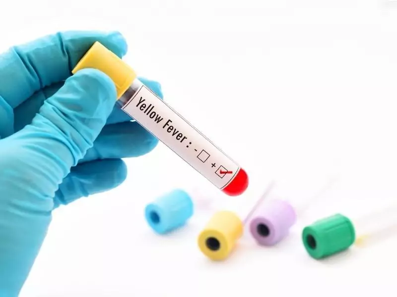Fiebre Amarilla - Inmunología