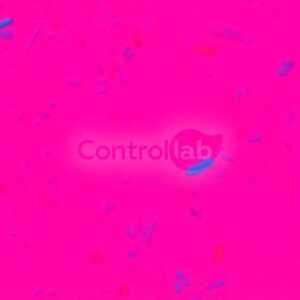 Liquido Sinovial Cristais
