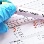 Amostra de sangue para teste de marcador tumoral
