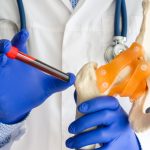 Diagnóstico médico de laboratório, testes de ossos e foto do conceito comum. Médico ou técnico de laboratório segura em uma mão um tubo de ensaio de laboratório com sangue, na outra mão - modelo de osso e articulação do quadril