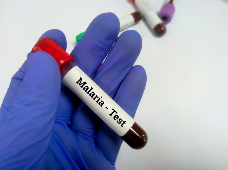 NAT Malaria