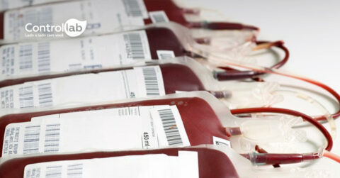 Controle da qualidade em hemoterapia | Controllab