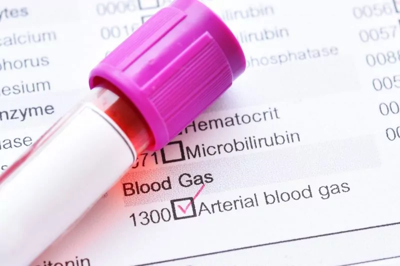 Tubo de amostra de sangue para teste de gasometria arterial
