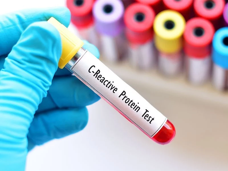 Proteína C Reactiva - Inmunología