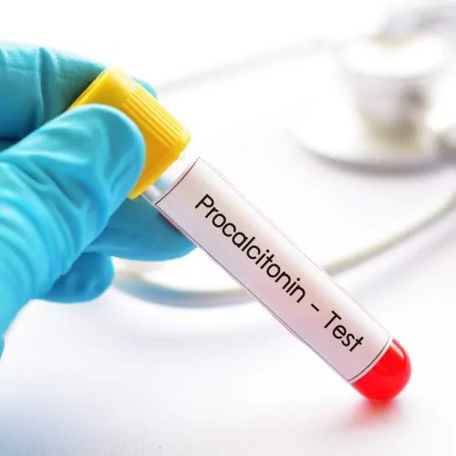 Tubo de amostra de sangue para teste de procalcitonina