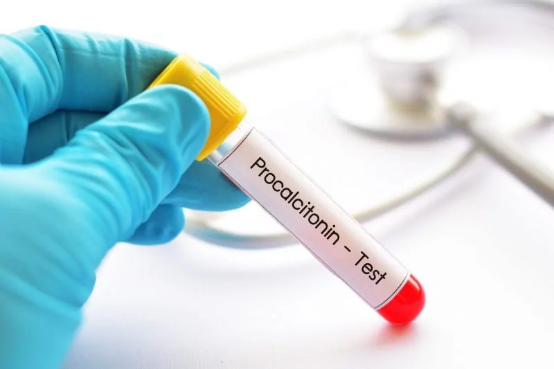 Tubo de amostra de sangue para teste de procalcitonina