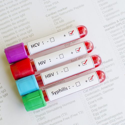 Doenças sexualmente transmissíveis: HIV, HBV, HCV, Sífilis