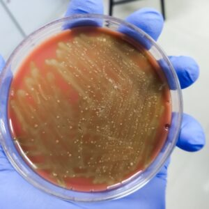 Streptococcus do grupo A GAS cultura