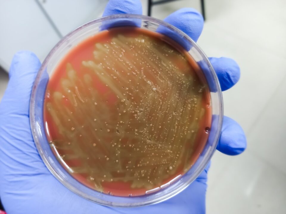Group A Streptococcus GAS Culture Controllab