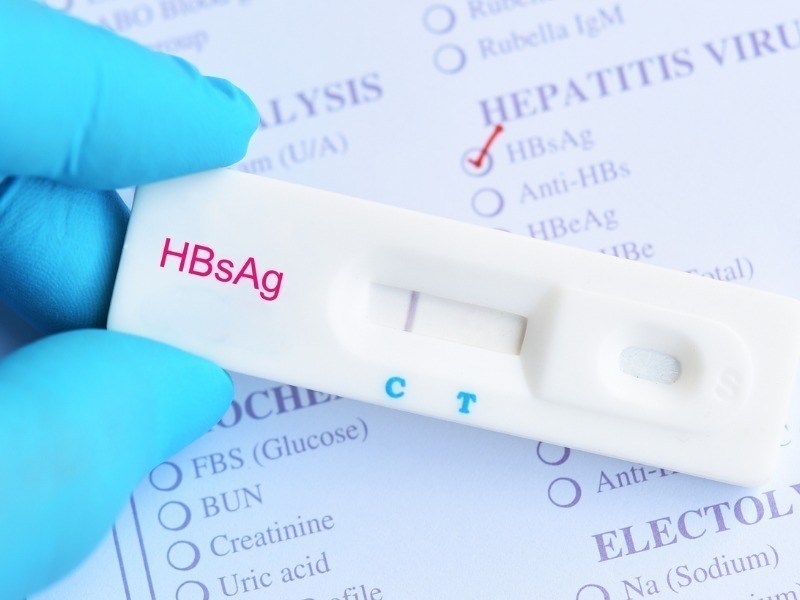 TLR HBsAg hepatitis b virus negative test result picture id1002989740