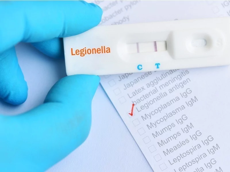 TLR Legionella pneumophila legionella positive test result picture id994964130