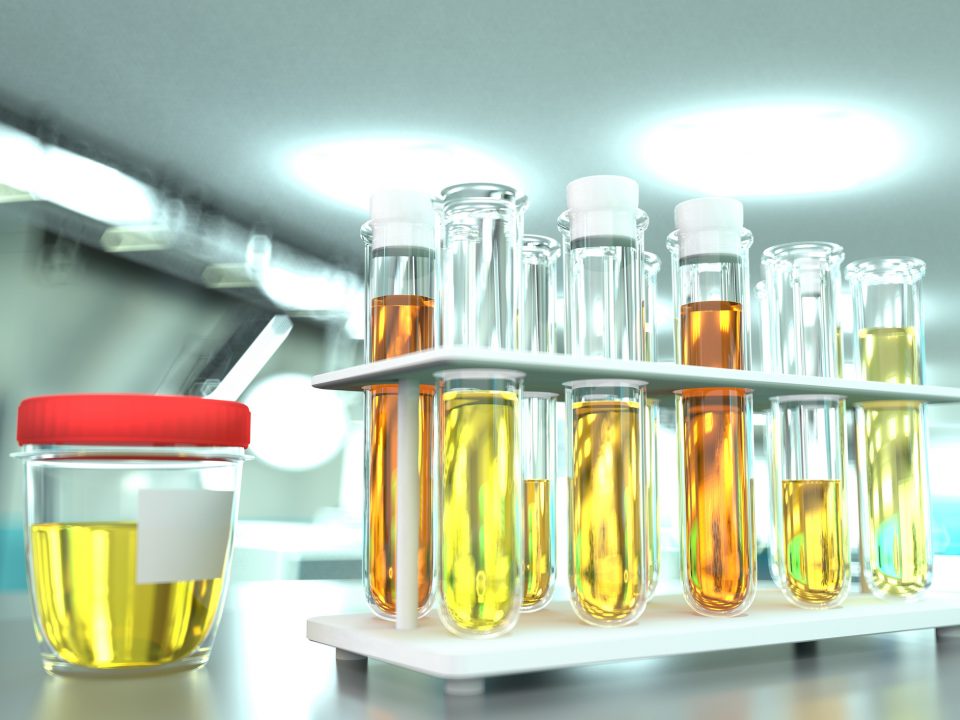 provas laboratoriais em clínica de microbiologia moderna - teste de qualidade da urina para cristais ou infecção, ilustração médica em 3D