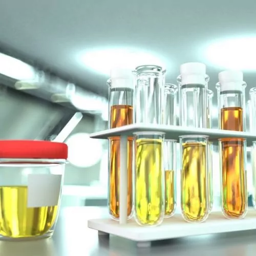 provas laboratoriais em clínica de microbiologia moderna - teste de qualidade da urina para cristais ou infecção, ilustração médica em 3D
