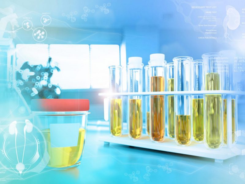 Teste de amostra de urina para nitrito ou bactéria - tubos de ensaio no escritório de pesquisa de química moderna, ilustração médica 3D
