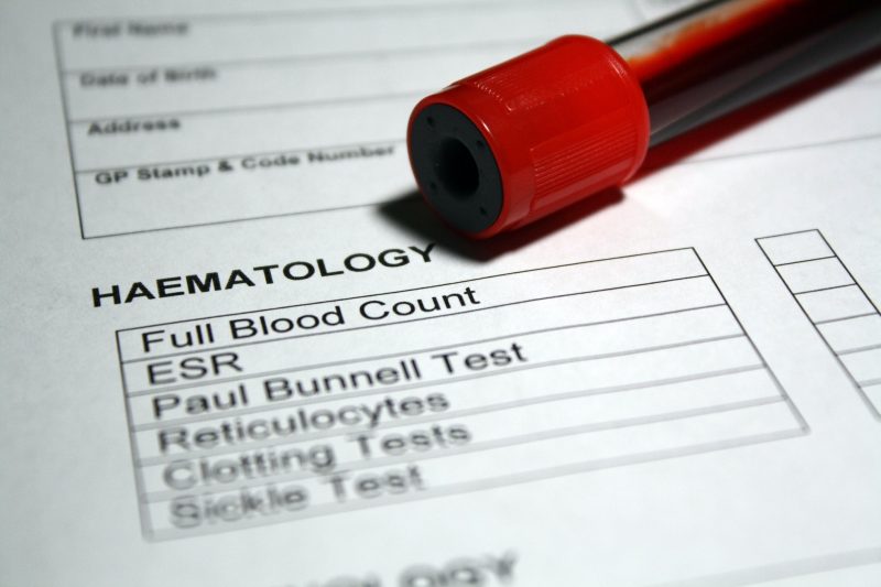 Teste de hematologia de sangue