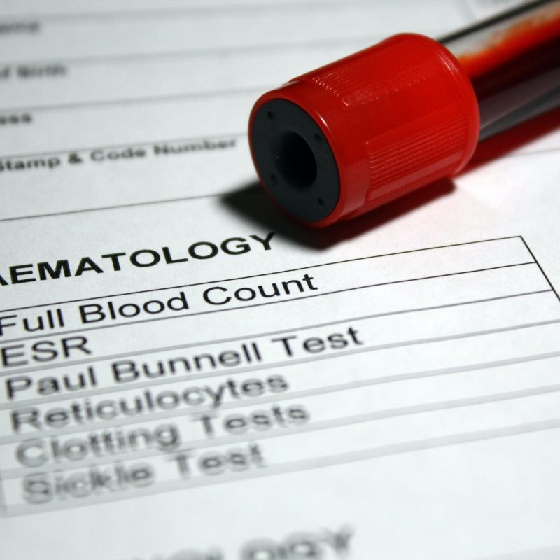 Teste de hematologia de sangue