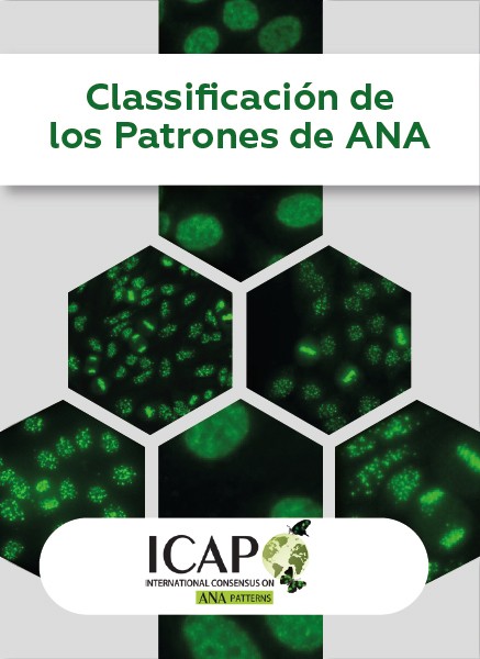 Classificación de los Patrones de ANA Classificación de los Patrones de ANA