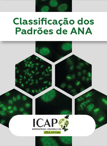 Classificação dos Padrões de ANA Classificação dos Padrões de ANA