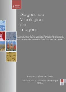 Diagnostico-Micologico-por-Imagens-final