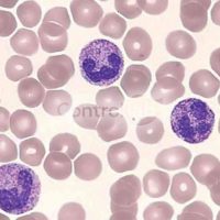 Hematoscopia