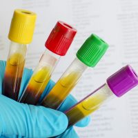 Amostra de sangue para exames laboratoriais