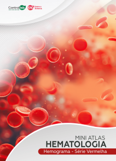 Mini-Atlas de Hematologia, 
Hemograma - Série Vermelha