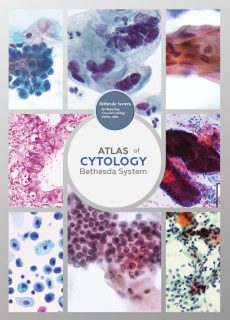 Bethesda Cytology Atlas