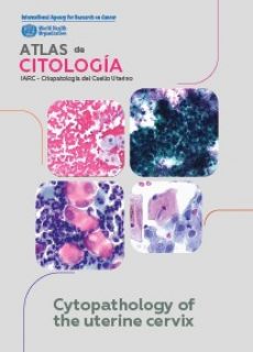 Citopatología del Cuello Uterino