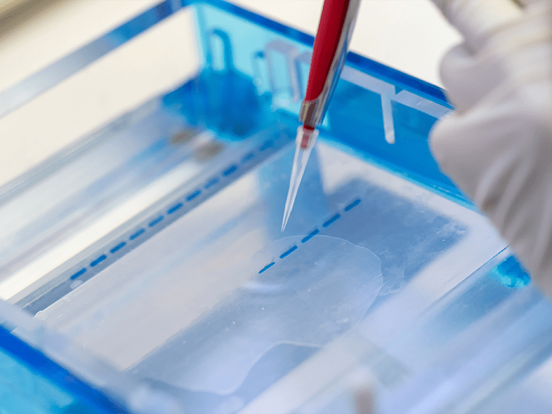 Eletroforese das Lipoproteínas