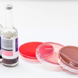 hemoculturas