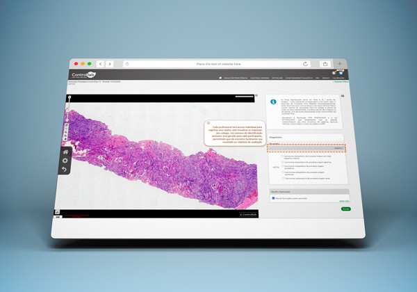 Reporte para múltiplos microscopistas