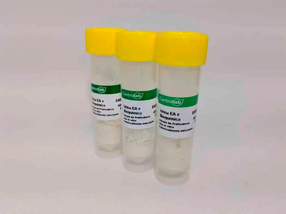 urinalise bioquimica 1 2