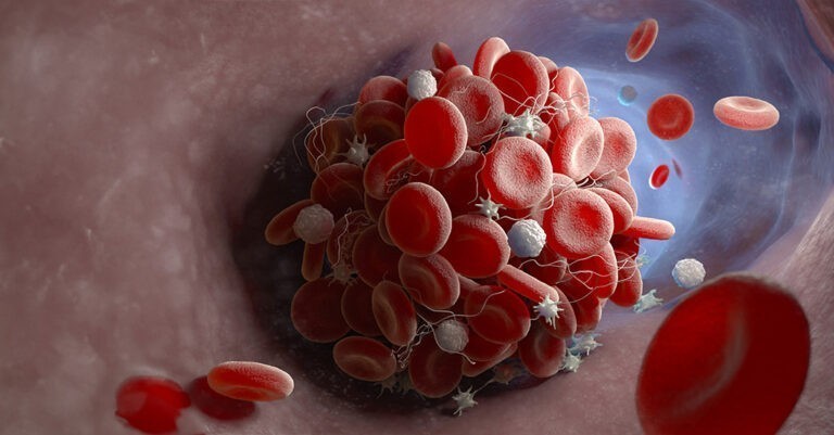 Controllab promove capacitação gratuita sobre anticoagulante lúpico